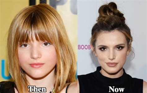 does bella thorne have fake boobs|Bella Thorne’s Plastic Surgery – What We Know So Far